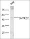 5-Hydroxytryptamine Receptor 2C antibody, orb13225, Biorbyt, Western Blot image 