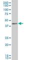 LAG1 longevity assurance homolog 6 antibody, H00253782-A01, Novus Biologicals, Western Blot image 