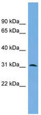 Dual adapter for phosphotyrosine and 3-phosphotyrosine and 3-phosphoinositide antibody, TA334529, Origene, Western Blot image 