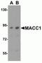 MET Transcriptional Regulator MACC1 antibody, NBP2-82006, Novus Biologicals, Western Blot image 