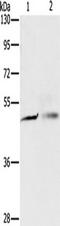PiggyBac Transposable Element Derived 4 antibody, TA349450, Origene, Western Blot image 