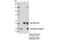 Sodium channel subunit beta-1 antibody, 13950S, Cell Signaling Technology, Immunoprecipitation image 