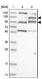 GTPase Activating Protein And VPS9 Domains 1 antibody, NBP1-85137, Novus Biologicals, Western Blot image 