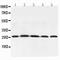 Adiponectin, C1Q And Collagen Domain Containing antibody, PB9011, Boster Biological Technology, Western Blot image 