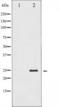 Troponin I, cardiac muscle antibody, TA325945, Origene, Western Blot image 