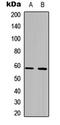 6-Phosphofructo-2-Kinase/Fructose-2,6-Biphosphatase 2 antibody, GTX55273, GeneTex, Western Blot image 