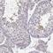 Spermatogenesis Associated 32 antibody, HPA024549, Atlas Antibodies, Immunohistochemistry paraffin image 