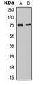 Cell Division Cycle 25A antibody, LS-C354606, Lifespan Biosciences, Western Blot image 