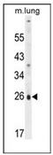Solute Carrier Family 66 Member 2 antibody, AP53427PU-N, Origene, Western Blot image 