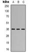 Cysteinyl Leukotriene Receptor 1 antibody, orb319082, Biorbyt, Western Blot image 