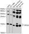 40S ribosomal protein S20 antibody, GTX64800, GeneTex, Western Blot image 