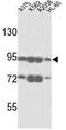 ATP Binding Cassette Subfamily B Member 5 antibody, GTX81935, GeneTex, Western Blot image 