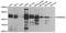Ubiquitin Conjugating Enzyme E2 U antibody, A16541-1, Boster Biological Technology, Immunohistochemistry paraffin image 