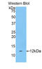 Fibrinogen Alpha Chain antibody, LS-C294148, Lifespan Biosciences, Western Blot image 