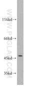Beta-sarcoglycan antibody, 11936-1-AP, Proteintech Group, Western Blot image 