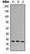 Calcium Voltage-Gated Channel Auxiliary Subunit Gamma 4 antibody, orb323239, Biorbyt, Western Blot image 