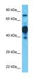 Signal Peptide Peptidase Like 2C antibody, orb325854, Biorbyt, Western Blot image 