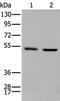 PTOV1 Extended AT-Hook Containing Adaptor Protein antibody, PA5-67569, Invitrogen Antibodies, Western Blot image 