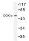 Diacylglycerol Kinase Epsilon antibody, AP20421PU-N, Origene, Western Blot image 