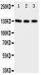 NT-3 growth factor receptor antibody, PA1992, Boster Biological Technology, Western Blot image 