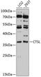 Cathepsin L antibody, 14-245, ProSci, Western Blot image 