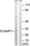 Secretory carrier-associated membrane protein 1 antibody, TA314924, Origene, Western Blot image 
