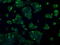 L1 Cell Adhesion Molecule antibody, GTX84241, GeneTex, Immunofluorescence image 