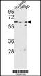 Glucosamine (N-Acetyl)-6-Sulfatase antibody, 62-334, ProSci, Western Blot image 