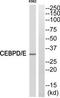 CCAAT Enhancer Binding Protein Delta antibody, TA311682, Origene, Western Blot image 