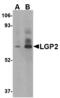 Probable ATP-dependent RNA helicase DHX58 antibody, MBS150606, MyBioSource, Western Blot image 
