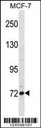 FCRH5 antibody, 58-413, ProSci, Western Blot image 