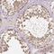 Chromosome 10 Open Reading Frame 67 antibody, NBP1-81068, Novus Biologicals, Immunohistochemistry paraffin image 