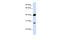 ETS Transcription Factor ELK3 antibody, P100856_P050, Aviva Systems Biology, Western Blot image 