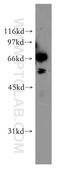 Ephrin B2 antibody, 12499-1-AP, Proteintech Group, Western Blot image 