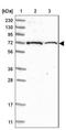 Zinc Finger Protein 592 antibody, NBP1-86647, Novus Biologicals, Western Blot image 