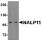 NLR Family Pyrin Domain Containing 11 antibody, TA320143, Origene, Western Blot image 