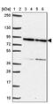 Von Willebrand Factor A Domain Containing 5B2 antibody, PA5-63955, Invitrogen Antibodies, Western Blot image 