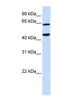 Tripartite Motif Containing 54 antibody, NBP1-52899, Novus Biologicals, Western Blot image 