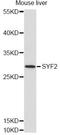 SYF2 Pre-MRNA Splicing Factor antibody, LS-C749398, Lifespan Biosciences, Western Blot image 