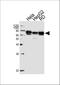 Protein Kinase AMP-Activated Non-Catalytic Subunit Gamma 3 antibody, A04841, Boster Biological Technology, Western Blot image 