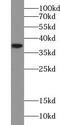 Ubiquitin thioesterase OTU1 antibody, FNab09567, FineTest, Western Blot image 