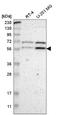 Zinc Finger Protein 230 antibody, NBP2-58880, Novus Biologicals, Western Blot image 