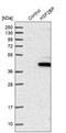 O-Linked N-Acetylglucosamine antibody, NBP1-86325, Novus Biologicals, Western Blot image 