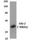 Serine Peptidase Inhibitor, Kunitz Type 2 antibody, GTX52776, GeneTex, Western Blot image 