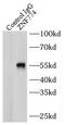 Zinc Finger Protein 774 antibody, FNab09740, FineTest, Immunoprecipitation image 