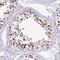 Family With Sequence Similarity 122A antibody, NBP2-31646, Novus Biologicals, Immunohistochemistry paraffin image 