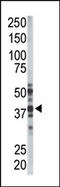 Palmitoyl-Protein Thioesterase 1 antibody, AP12266PU-N, Origene, Western Blot image 
