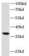 Follistatin antibody, FNab03182, FineTest, Western Blot image 