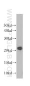 Copper Metabolism Domain Containing 1 antibody, 11938-1-AP, Proteintech Group, Western Blot image 