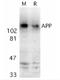 Amyloid Beta Precursor Protein antibody, AP05817PU-N, Origene, Western Blot image 